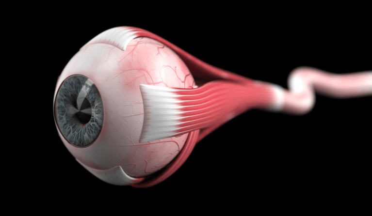 OCT del nervio óptico para el diagnóstico precoz del glaucoma en Padilla Oftalmología Madrid